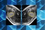 mit-jameel-clinic-fetal-brain.jpg