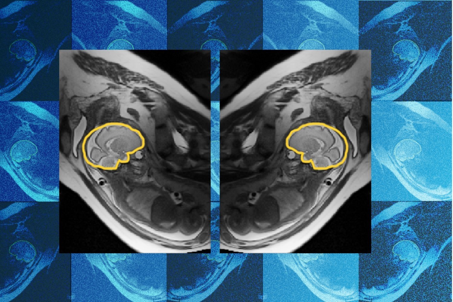 mit-jameel-clinic-fetal-brain.jpg